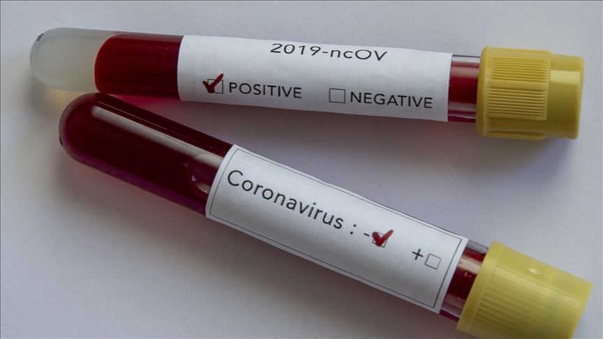 Le vice-président du Soudan du Sud et sa femme testés positifs de COVID-19