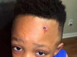 Une fausse blessure par balle peinte sur le front d'un élève noir