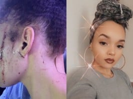 Une-femme-arrêtée-pour-avoir-poignardé-la-nièce-de-Michael-Jackson-1