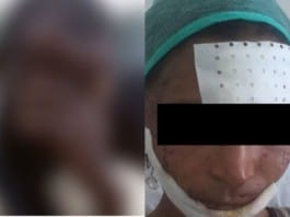 Yopougon Il tente d'égorger sa compagne