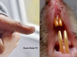 garçon mordu par rat