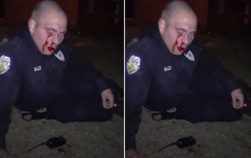 policier bastonné blessé