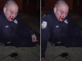 policier bastonné blessé