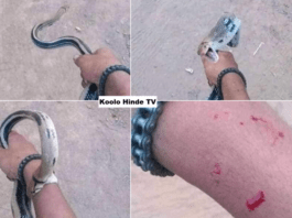 un homme mordu par un serpent