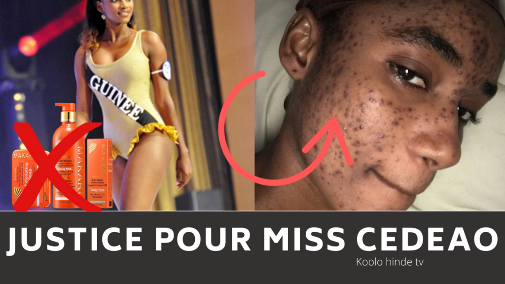 Mariama Diallo Miss Afrique de l'Ouest en justice