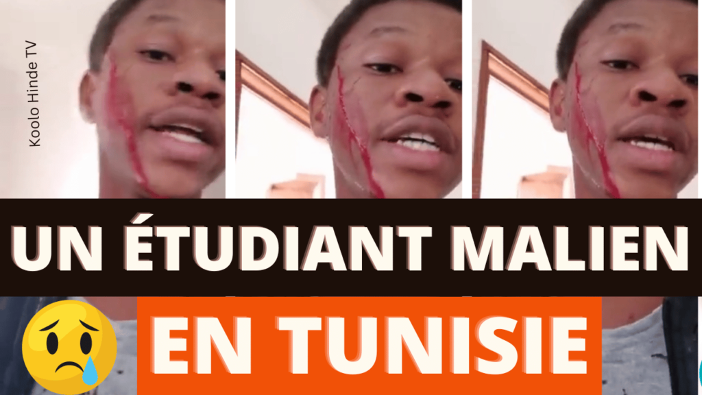 Un étudiant malien défiguré par un tunisien