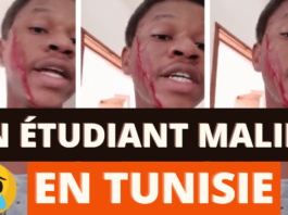 Un étudiant malien défiguré par un tunisien